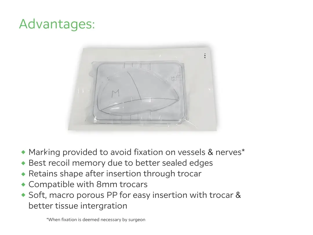 Advantages of WELKNIT™ 3D Anatomical Mesh